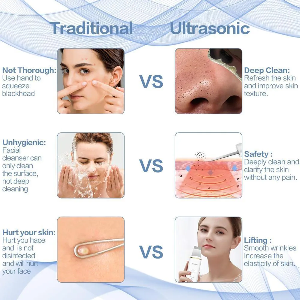 New Ultrasonic Ion Face Cleansing Skin Scrubber Peeling Shovel EMS
